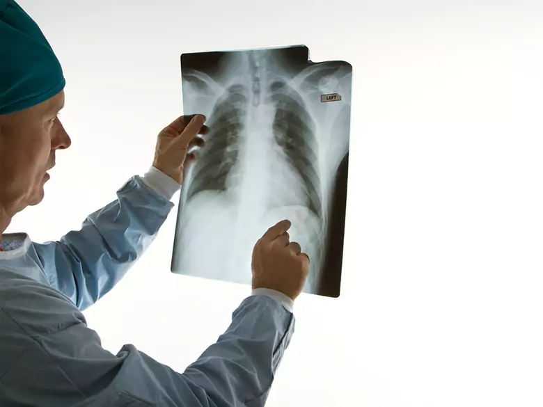 Badanie RTG w ciąży