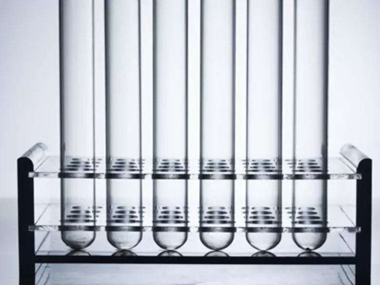 Wszystko o prolaktynie