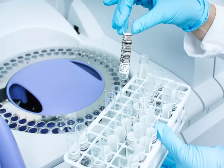 Czy komórki macierzyste przyspieszają zrastanie kości cukrzyków?