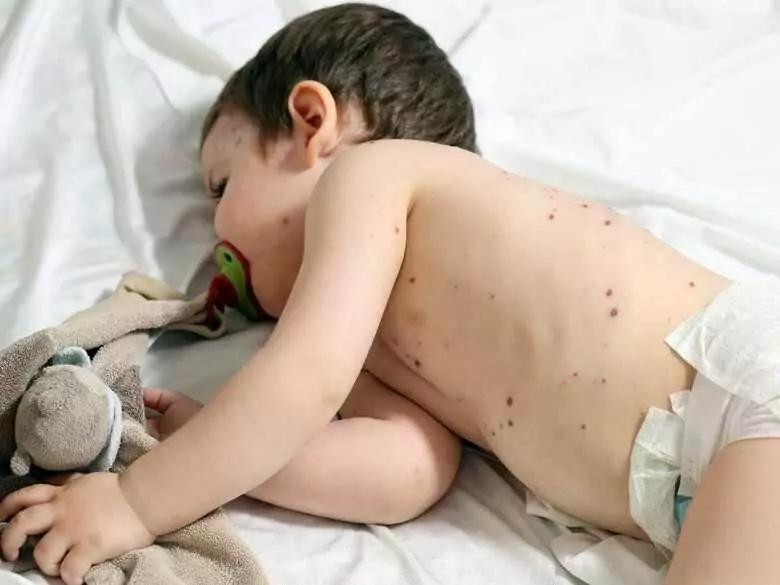 Rodzicu – nie bagatelizuj tych chorób