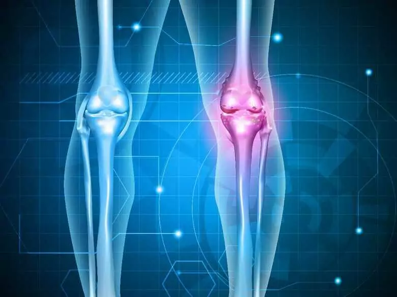 Co to jest zdrowa dieta dla osób z problemami z kośćmi?