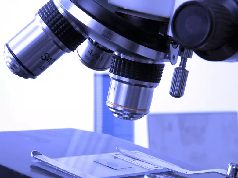 Objawy i przebieg toksokarozy