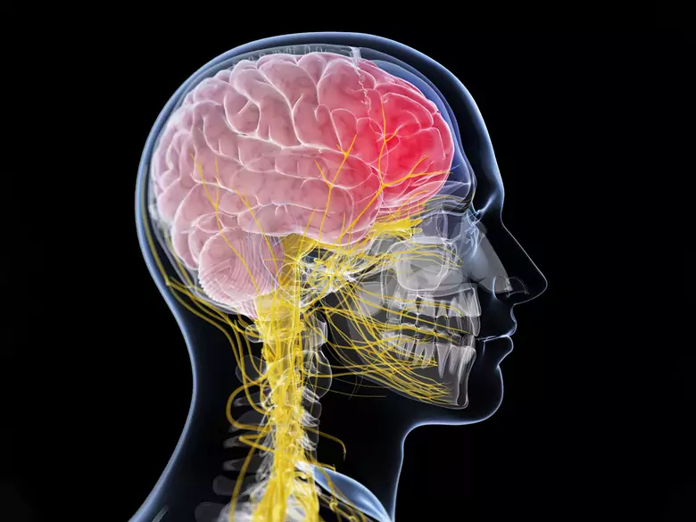 Jak radzić sobie z problemami z nadciśnieniem śródczaszkowym?