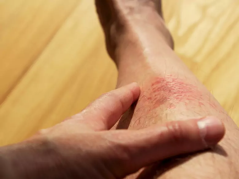 Ultradźwięki a szybsze gojenie się ran