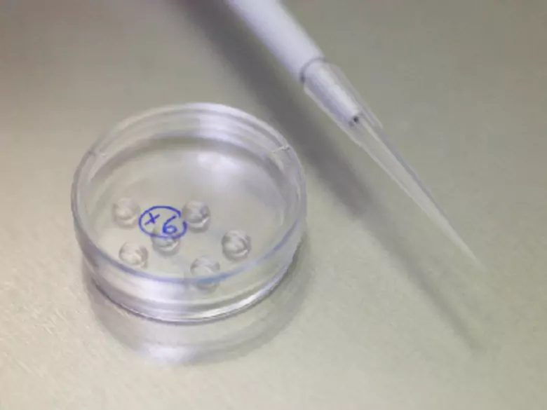 Czym są choroby rzadkie?