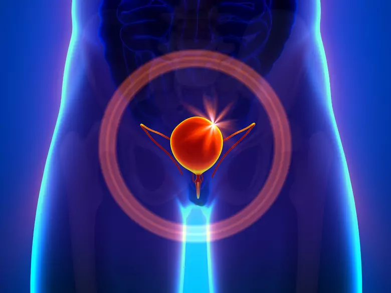 Co to jest zdrowa dieta dla osób z problemami z drogami moczowymi?