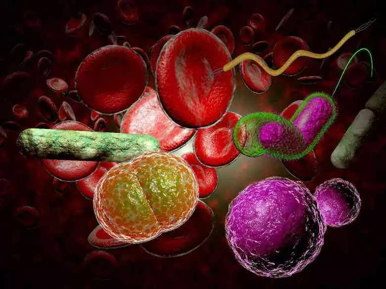 Sepsa – cichy zabójca. Niekorzystne wyniki raportu WHO